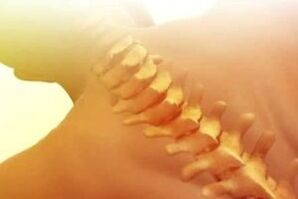 остеохондроза как да се лекува